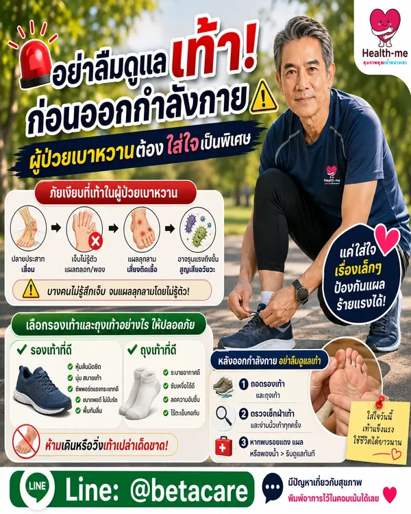 การเลือกถุงเท้าและรองเท้าก่อนออกกำลังกาย